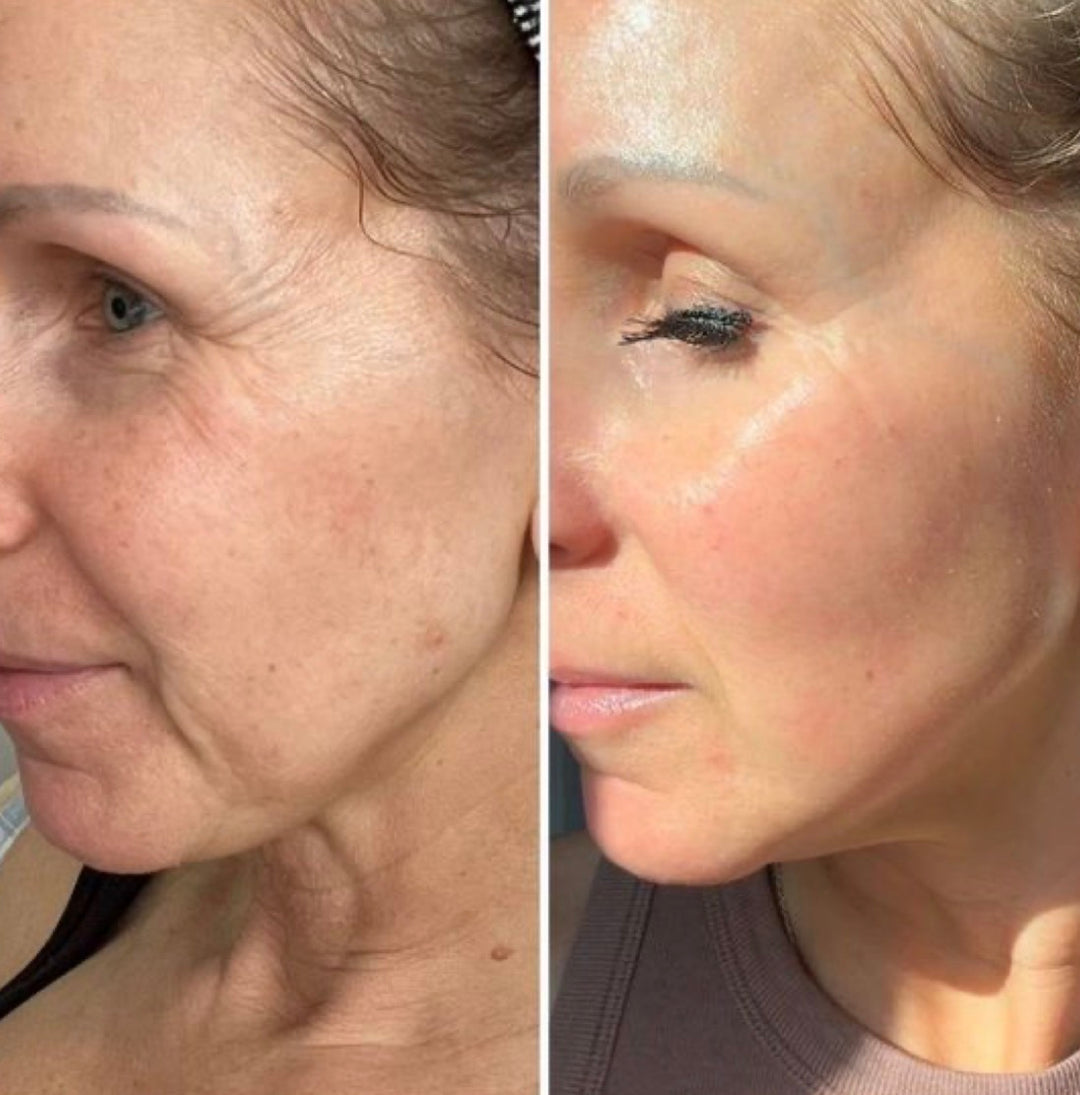 Aurea Gurkemeje sæbebar mod mørke pletter og tidlige aldringstegn