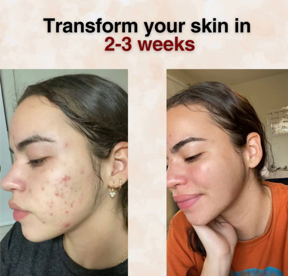 Aurea Gurkemeje sæbebar mod mørke pletter og tidlige aldringstegn